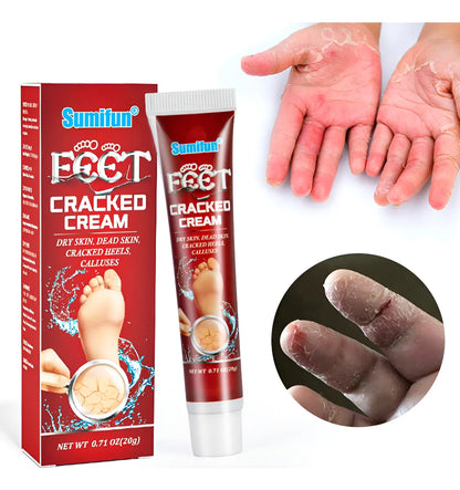 Crema para grietas en los pies + ENVÍO GRATIS🔥